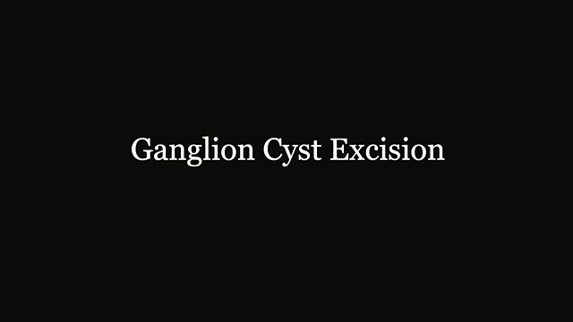What happens during a ganglion cyst excision?