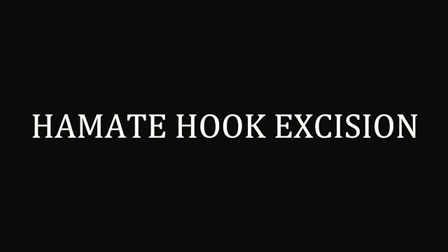 What happens during a hook of hamate excision?