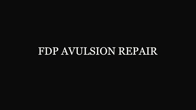 What happens during an FDP avulsion repair?