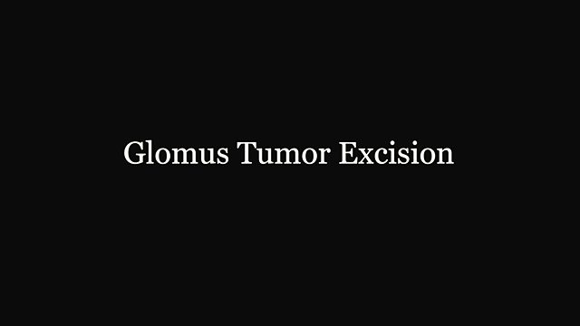 What happens during a glomus tumor excision? (the shorter recording)