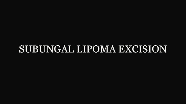 What happens during a subungual lipoma excision?