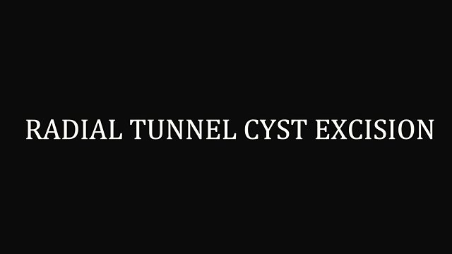 What happens when a cyst presses on the radial nerve?