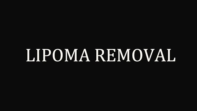What happens during a lipoma removal?