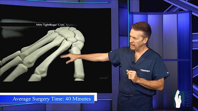 What is TMC joint replacement for thumb arthritis?