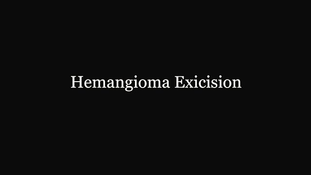 What happens during a hemangioma excision?
