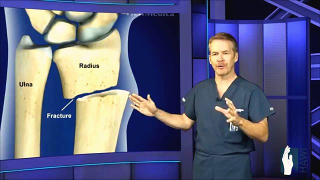 How is a broken wrist treated?