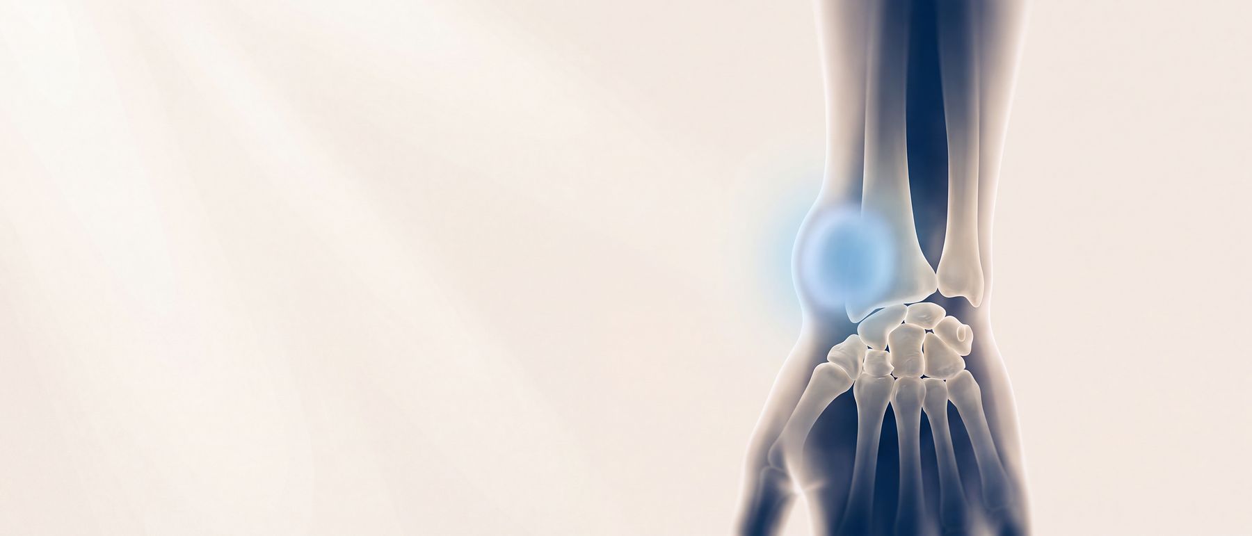 A three-dimensional illustration of a wrist with a smooth rounded swelling on the back of it, lit in blue.