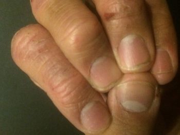 Hand-Finger-Nail atari breakout