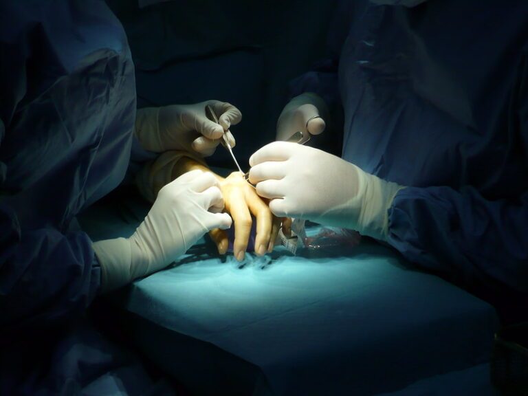 Rheumatoid Arthritis Surgery Recovery Hand and Wrist Institute