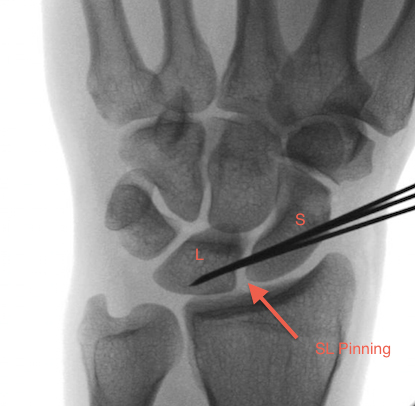 Non-surgical illustration