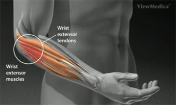 Overuse Injuries of the Elbow