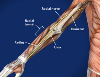 Radial Tunnel Syndrome - Physioflow PT