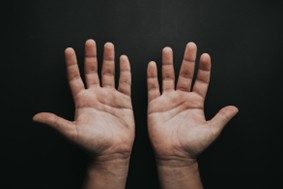 soft tissue injuries in hands