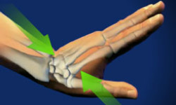 how hard do you have to hit your wrist to fracture it?